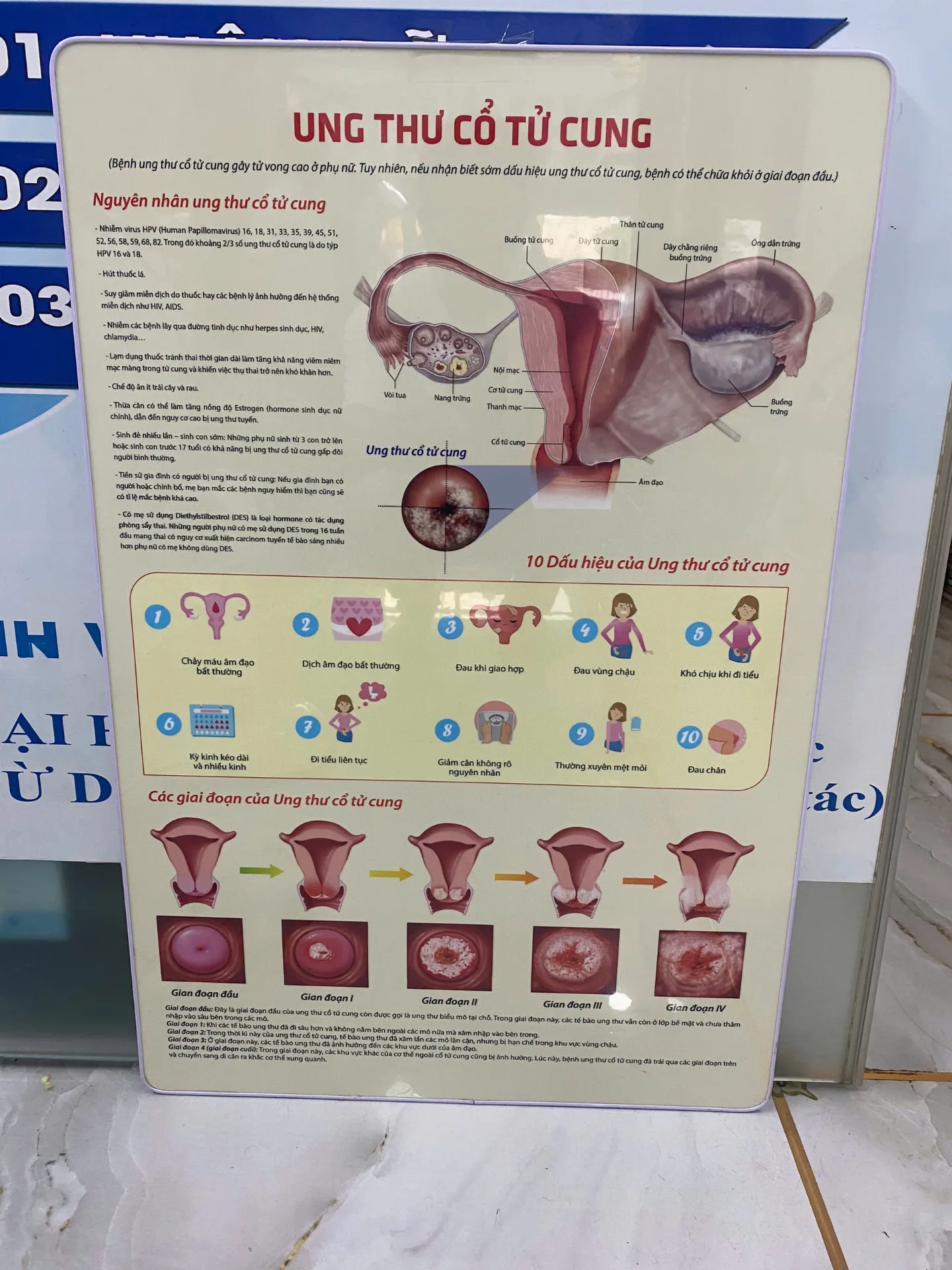 Ung thư cổ tử cung: Nhận biết sớm qua 7 dấu hiệu không thể bỏ qua